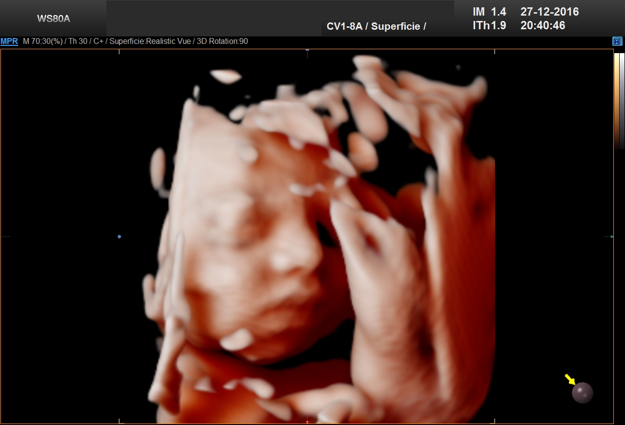 Ecogafa de tu bebe